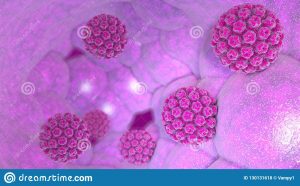 Papilloma virus infection